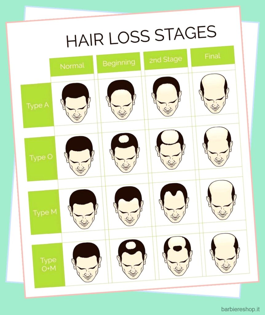Linee guida per il trattamento dell'attaccatura dei capelli: Prevenire, risolvere e migliorare 2